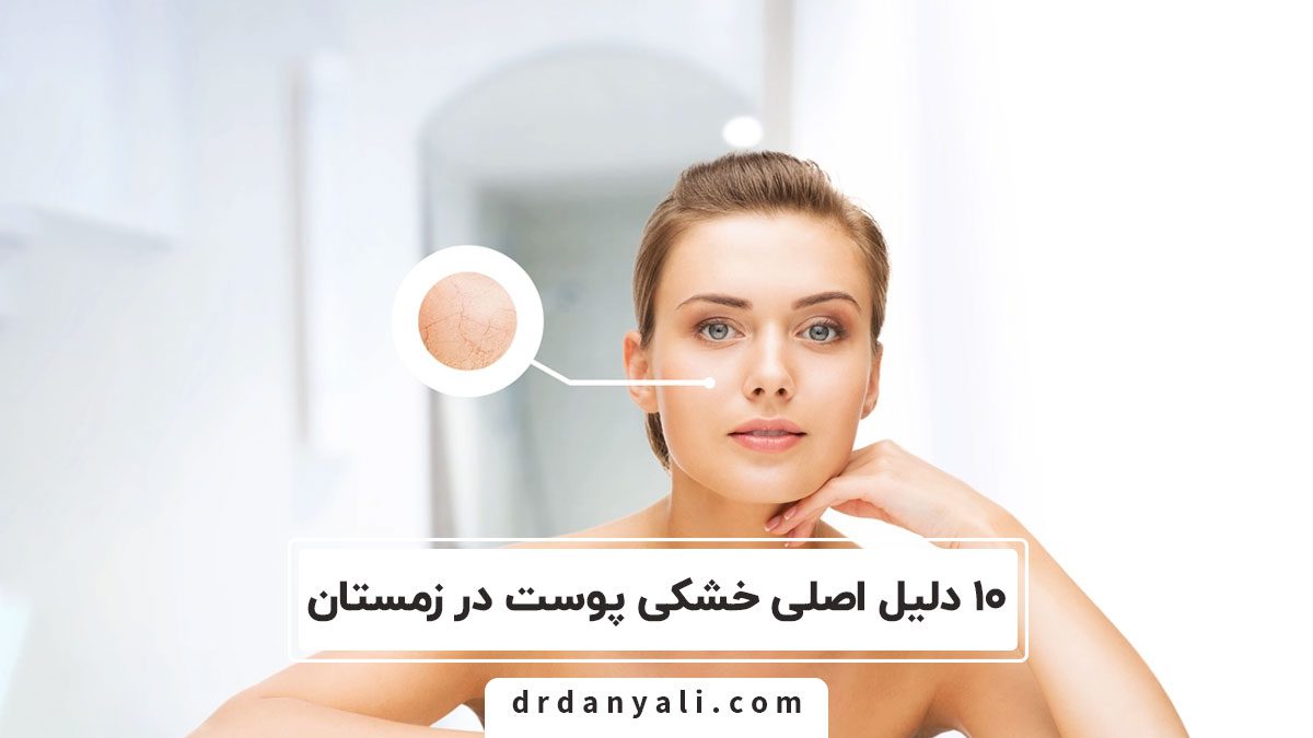 خشکی پوست