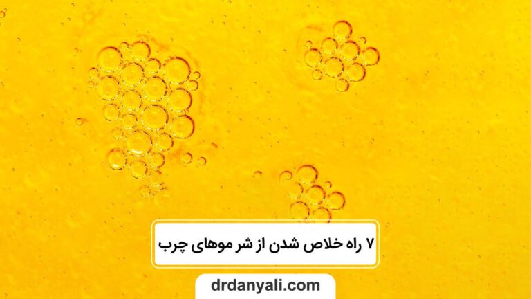 خلاص شدن از شر موهای چرب