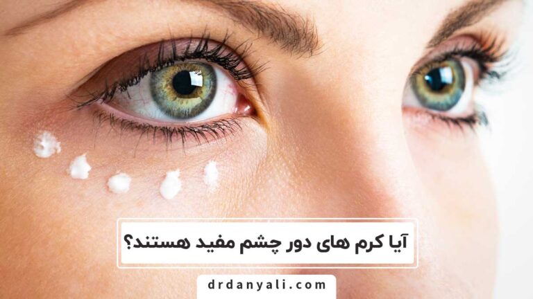 کرم های دور چشم