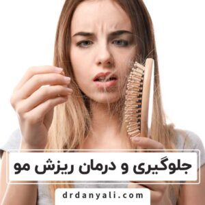 جلوگیری از ریزش مو