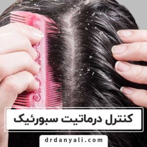 کنترل درماتیت سبورئیک