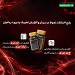 ایکس اید