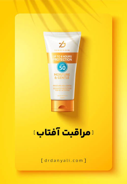 مراقب آفتاب