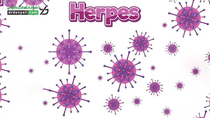 عود مجدد تبخال