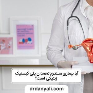 سندرم تخمدان پلی کیستیک