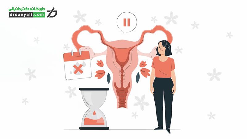 سندرم تخمدان پلی کیستیک