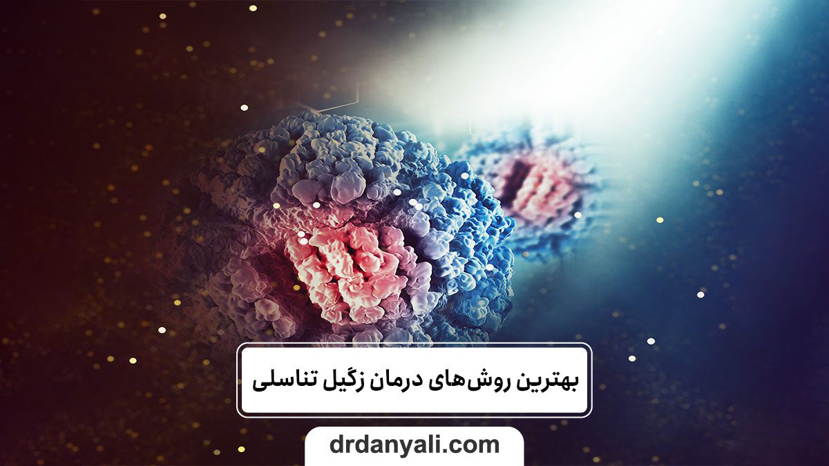 بهترین روش‌های درمان زگیل تناسلی