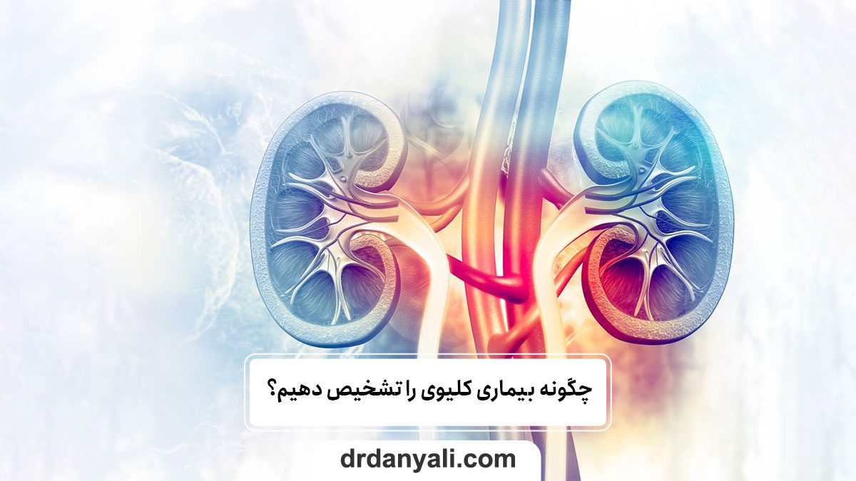 بیماری کلیوی