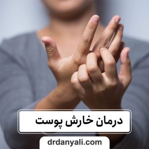 راهنمای کامل درمان خارش پوست