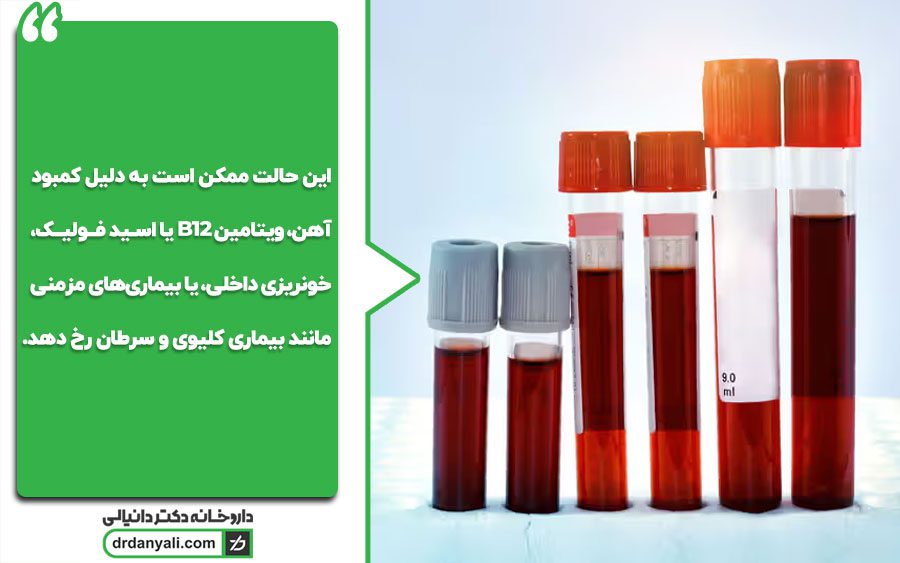 سطح پایین هماتوکریت (کم‌خونی)