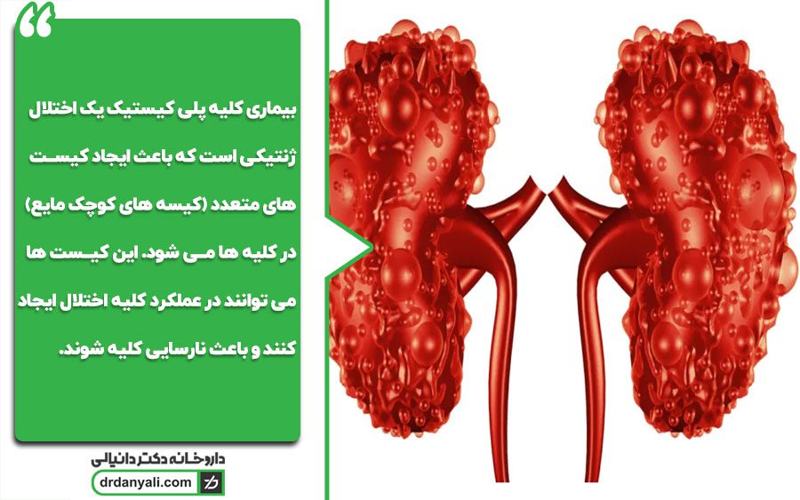 بیماری کلیه پلی‌کیستیک