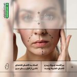 کرم لیفتینگ روز و شب درموبای