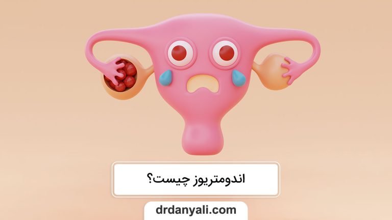 اندومتریوز چیست