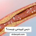 دیس لیپیدمی چیست؟ داروهای موثر در درمان آن