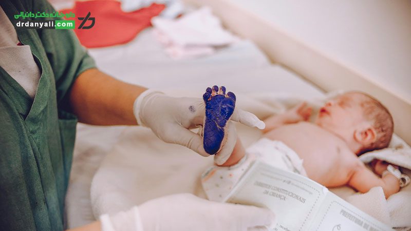 زردی در نوزادان