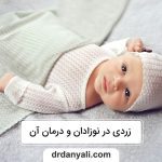 زردی در نوزادان