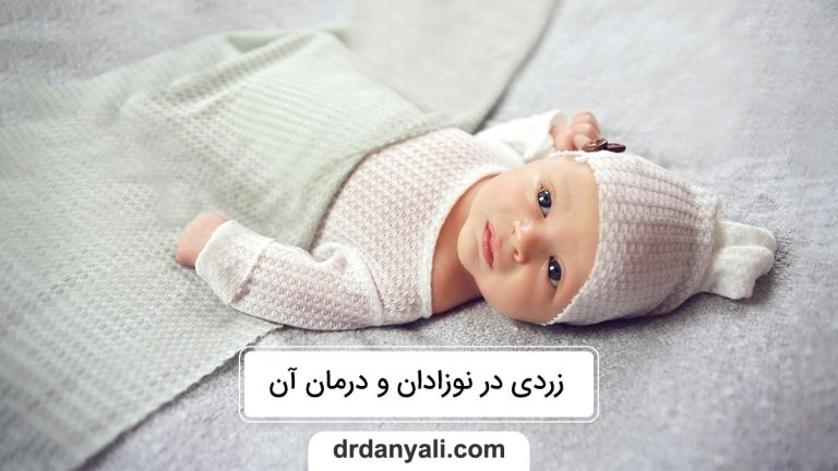 زردی در نوزادان