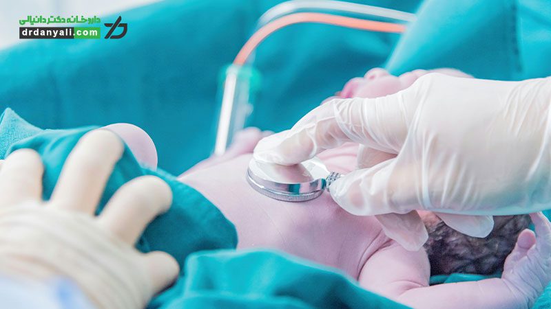 زردی در نوزادان