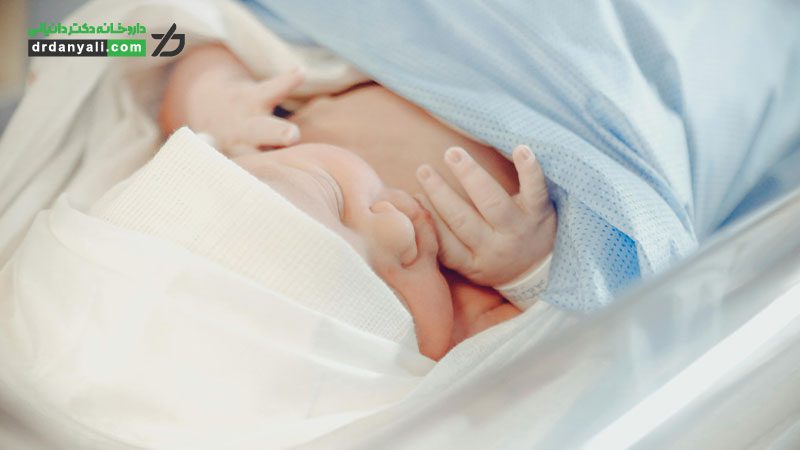 زردی در نوزادان