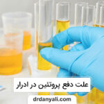 دفع پروتئین در ادرار