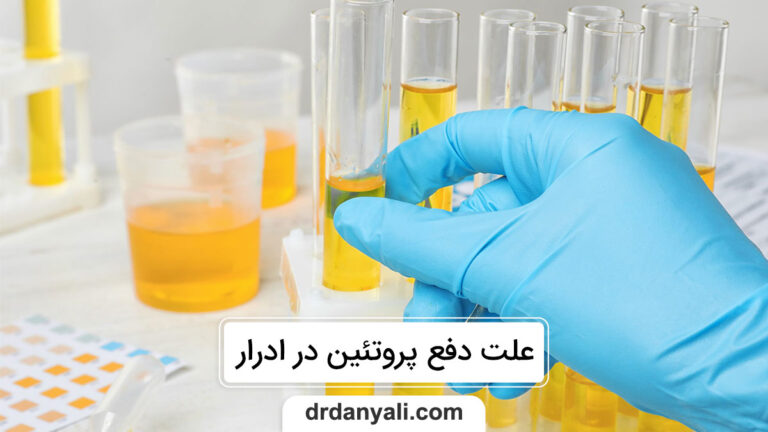 دفع پروتئین در ادرار
