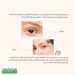 محلول تقویت ابرو لامینین
