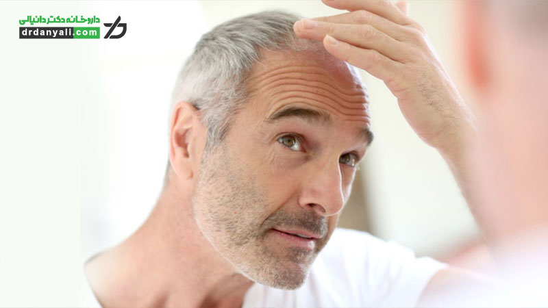 قرص ماینوکسیدیل برای ریزش مو