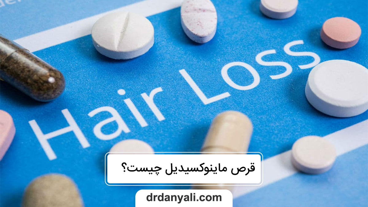 قرص ماینوکسیدیل برای ریزش مو